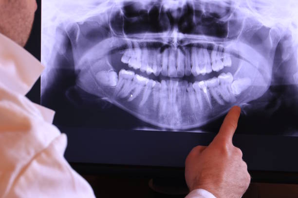 Best Cosmetic Emergency Dentistry in La Crescenta Montrose, CA